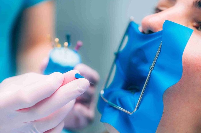 Endodoncia