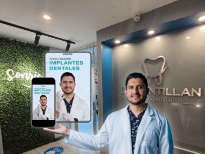 Ebook: Todo sobre implantes dentales